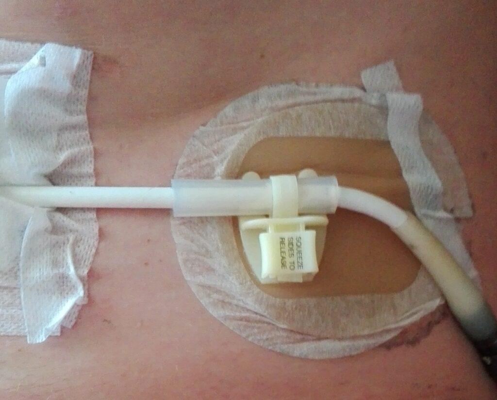 Kabel